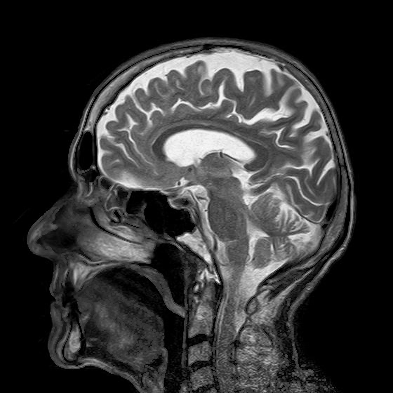 Bilim Adamları Kafatası ve Beyin Arasında Gizli Tüneller Buldu