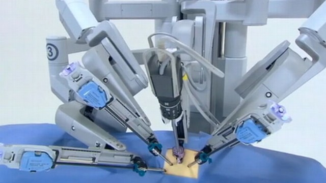 2 Saatlik Ameliyatı 2,5 Dakikada Yapan Robot