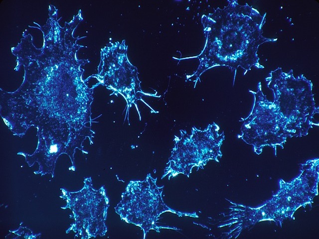 Yeni Kan Kanseri Tedavisi, Kanser Hücresi Sinyaline Seçici Olarak Müdahale Ediyor