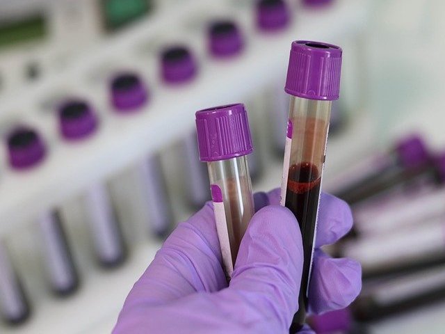 Kan Filtreleme Cihazına FDA’dan Acil İzin