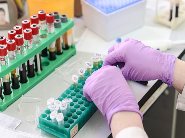 ABD'de Bir İlk: Evlerde Uygulanabilen Koronavirüs Testi