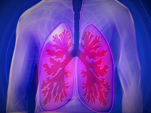 Yapay Zeka Akciğer Kanserini Teşhis Ediyor