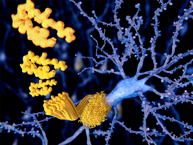 Araştırmacılar Alzheimer Tedavisi için Yeni Bir Hedef Keşfetti