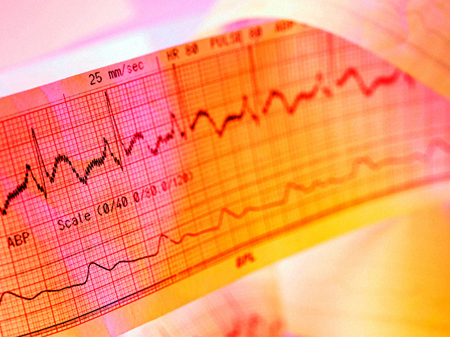 EKG Geliştirme Kiti Piyasaya Sürüldü