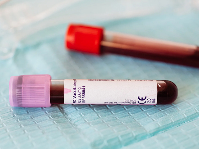 Çoklu Kanser Kan Testi NHS Çalışmasında Umut Vaat Ediyor