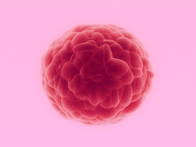 Meme Tümörü Hücreleri Yaygın Kanser Tedavisinden Nasıl Kaçınıyor?