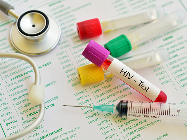 Evde Yapılabilen Ücretsiz HIV Testi