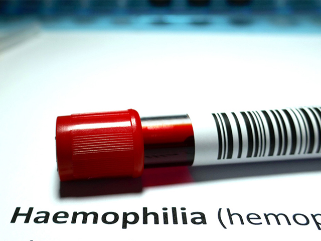 Araştırmacılar Hemofili Tedavisinde Değişiklikler Yapılmasını Öneriyor