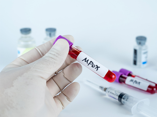 CRISPR Aracılığıyla Daha Hızlı Mpox Testi