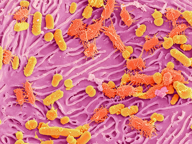 Yaygın Hastalıkların Ardındaki Sebep Olabilecek Oral Bakteriler
