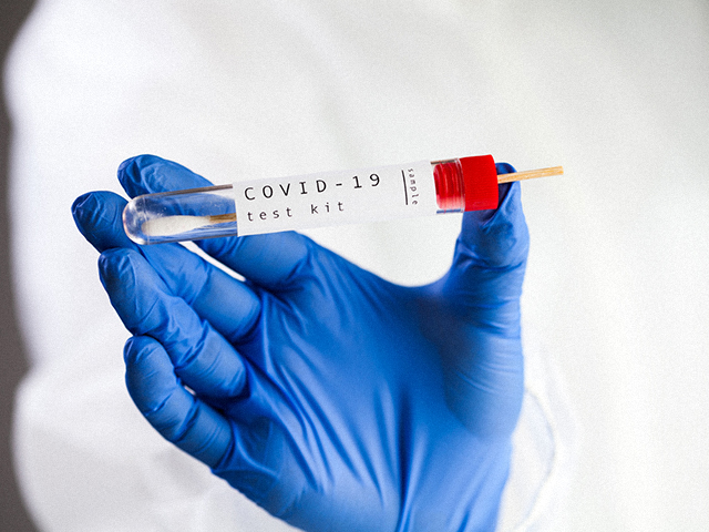 Novacyt Gerçek Zamanlı PCR Testi için İngiltere'den Onay Aldı