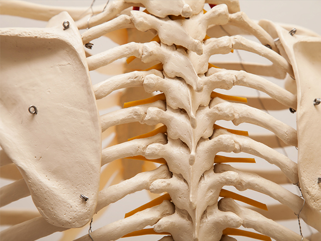 Akıllı İmplant Hastanın Spinal Füzyon Cerrahisindeki İlerlemesini izliyor