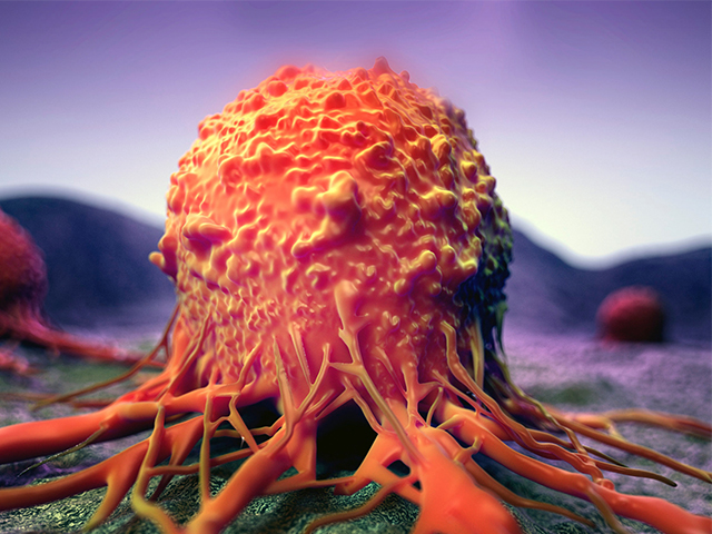 Yeni 3D Baskılı Tümör Modeli Kanser Tedavisine Seçenek Sunuyor
